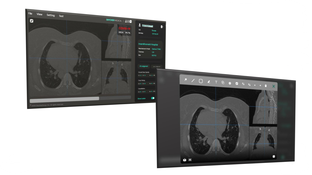 تشخیص کووید 19